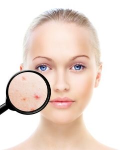 Anti Ageing & Acne Treatments, Birmingham beauty salon