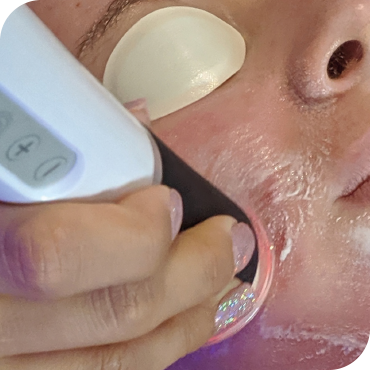 HydrO2 Facial Treatment HUSH Birmingham