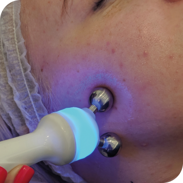 HydrO2 Facial Treatment HUSH Birmingham