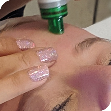HydrO2 Facial Treatment HUSH Birmingham