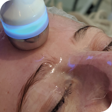HydrO2 Facial Hydration Hush Birmingham